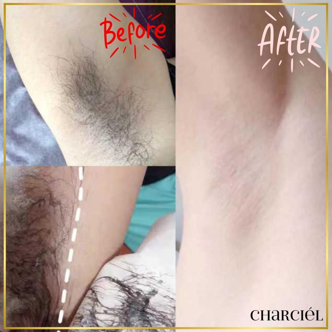 Charciél™ Hair Removal Cream - USA Formulated (old)